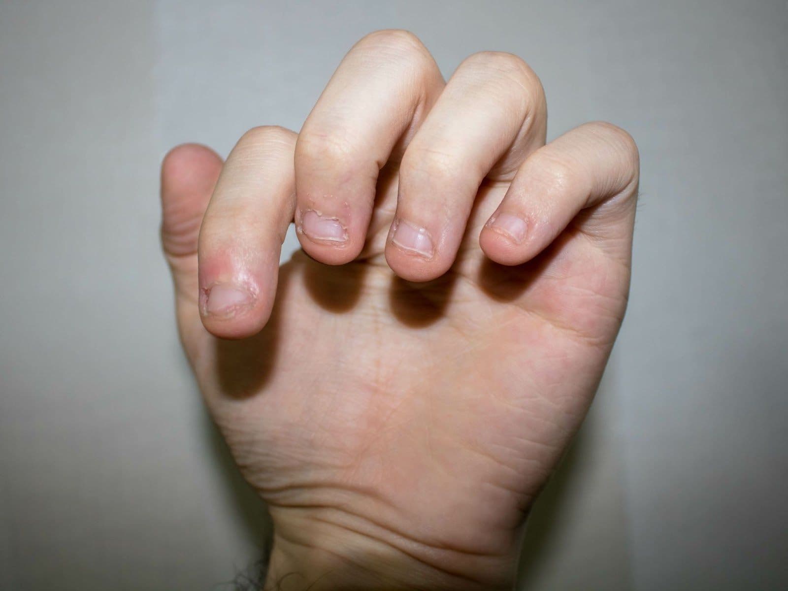 blog_image