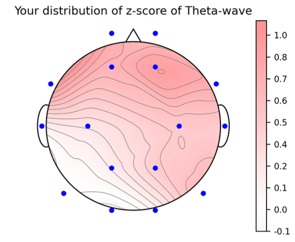 TMS治療のご案内